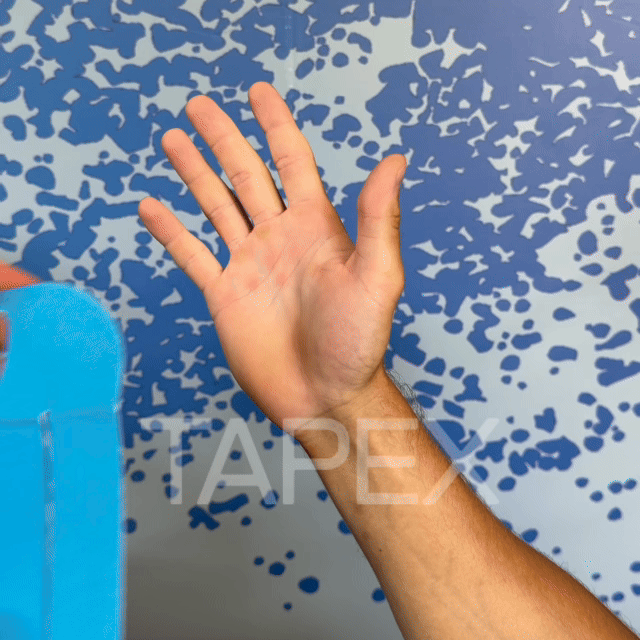 TAPEX™ - Handgelenk