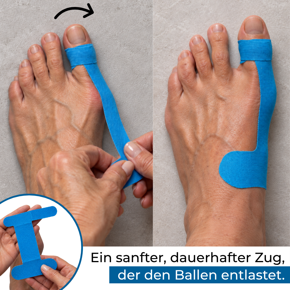 Hallux-Valgus Tape