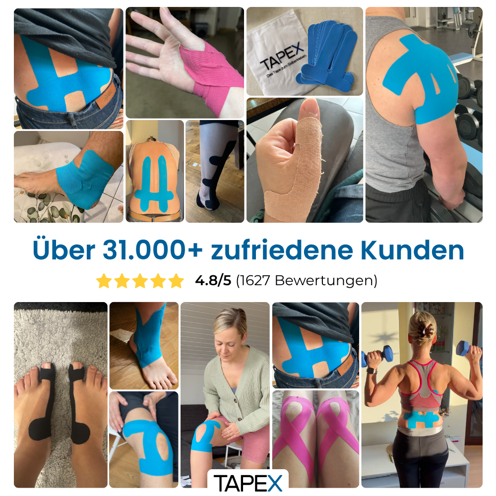 TAPEX™ - Kniegelenk