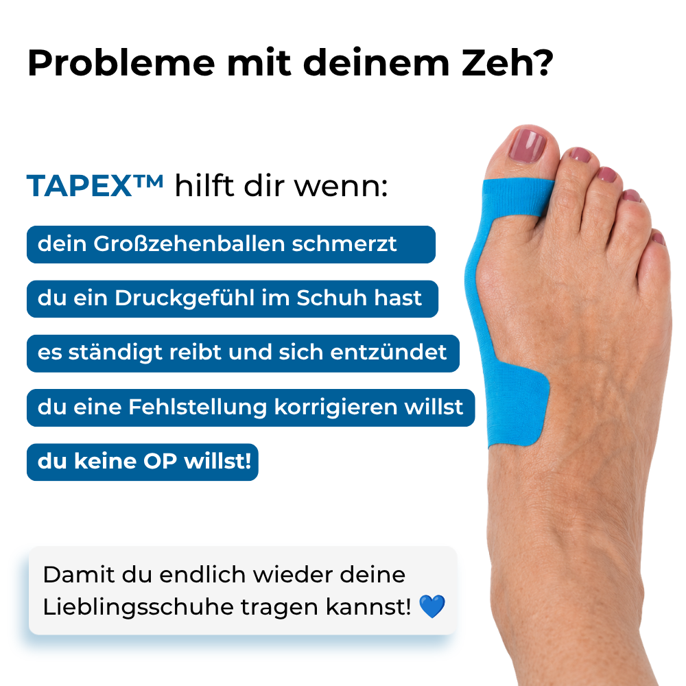 TAPEX™ Hallux-Valgus