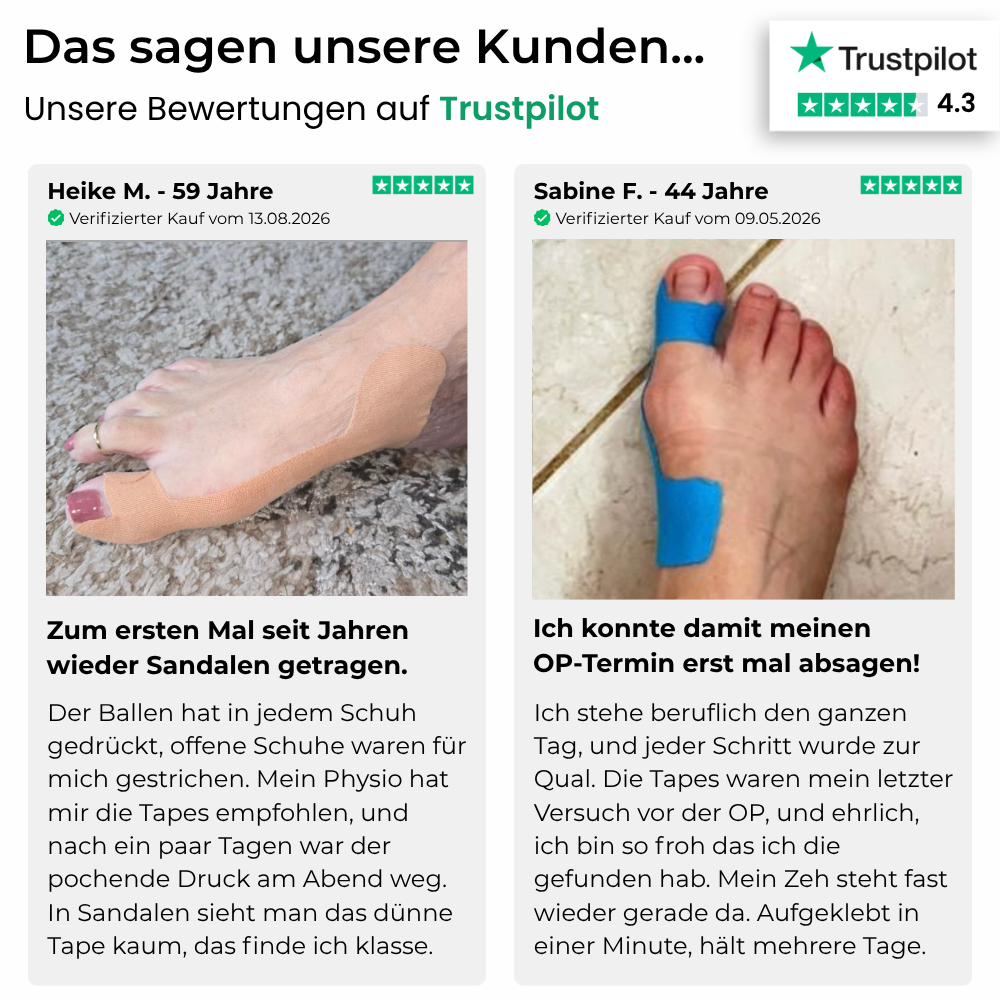 Hallux-Valgus
