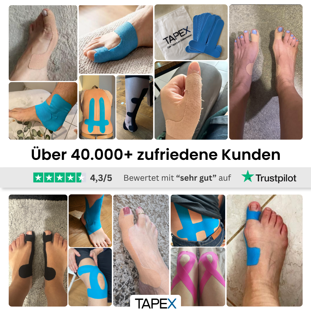 Hallux-Valgus