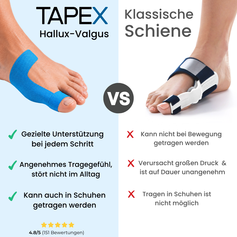 Hallux-Valgus